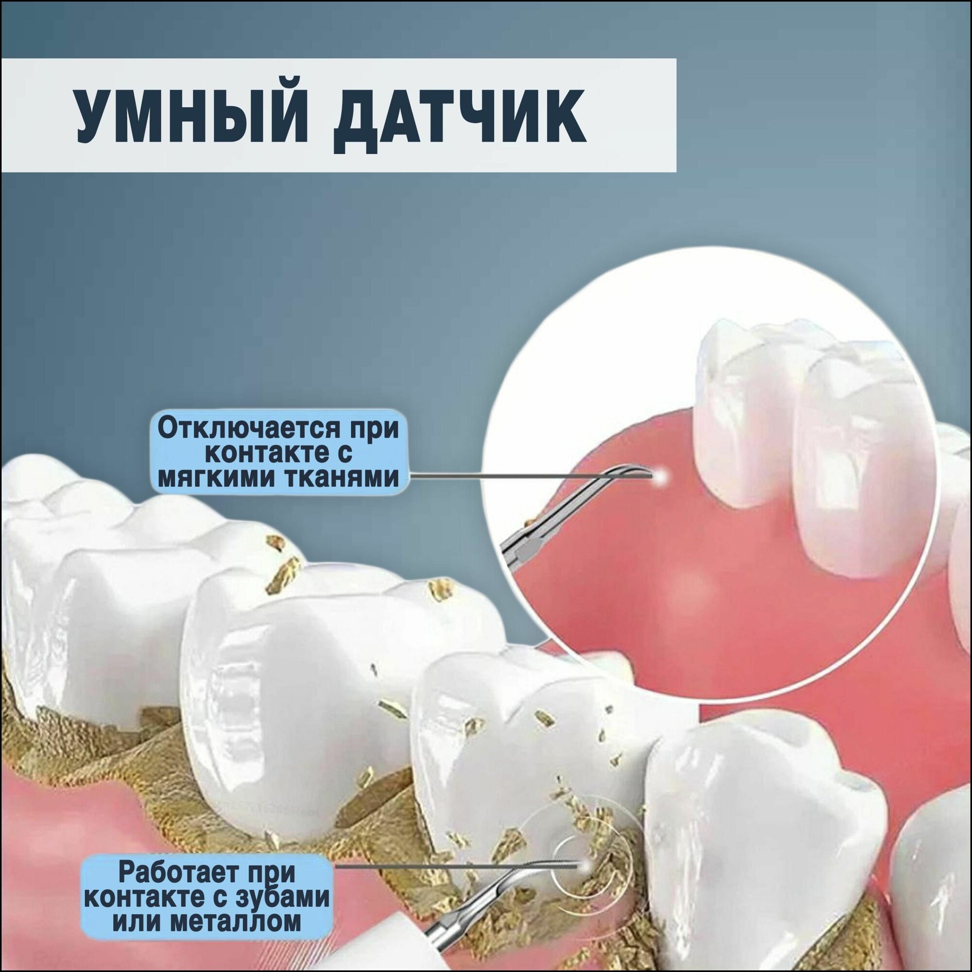 Портативный стоматологический ультразвуковой скалер Whitentice для удаления зубного камня и налета в домашних условиях — фото 1