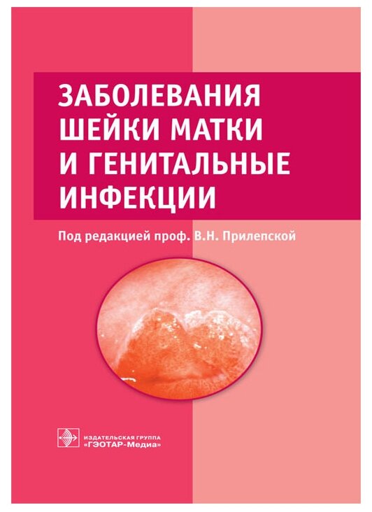 Прилепская В.Н. Абакарова П.Р. Байрамова Г.Р. "Заболевания шейки матки и генитальные инфекции"