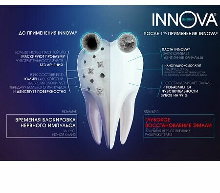 Зубная паста Innova Бережное осветление эмали, 75 мл - фото №15