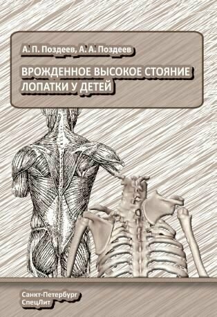 Врожденное высокое стояние лопатки у детей. Поздеев А. П.