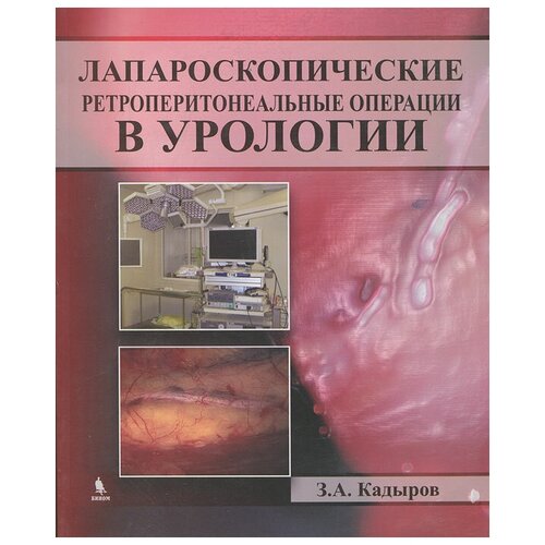 Кадыров Зиератшо Абдуллоевич "Лапароскопические ретроперитонеальные операции в урологии"