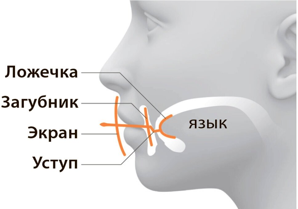 Устройство для лечения храпа Экстралор УПР-ЛХ