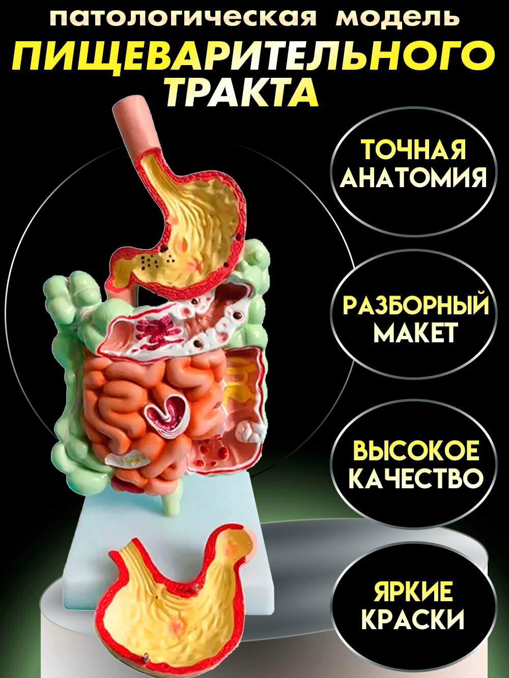 Патологическая модель толстой кишки желудочно-кишечного тракта в натуральную величину.