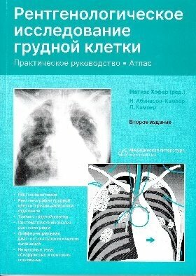 Рентгенологическое исследование грудной клетки. Практическое руководство. Атлас - фото №2