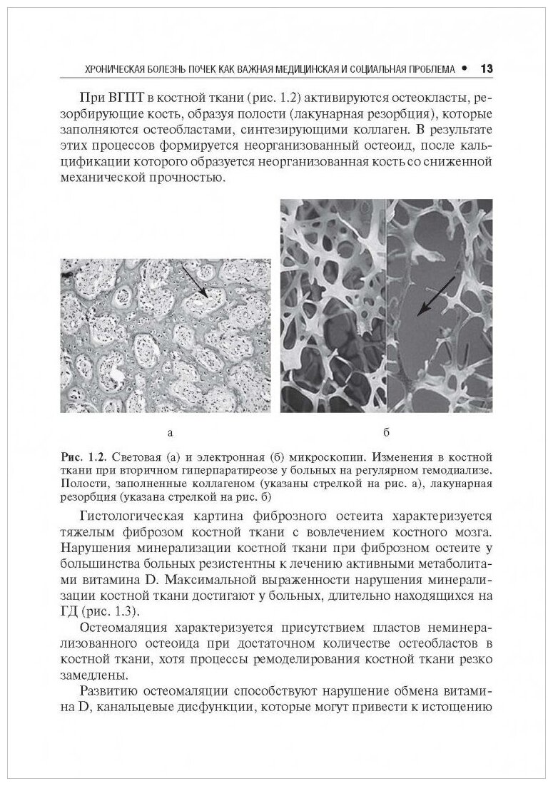 Нарушения минерального и костного обмена при хронической болезни почек - фото №7