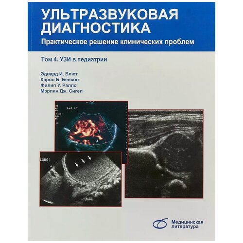 Блют Эдвард И., Сигел Мэрлин Дж. "Ультразвуковая диагностика. Практическое решение клинических проблем. Том 4. УЗИ в педиатрии"