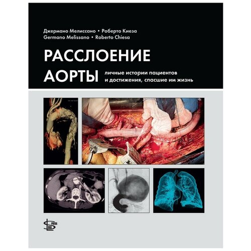 Мелиссано Дж, Киеза Р. "Расслоение аорты: личные истории пациентов и достижения, спасшие им жизнь"