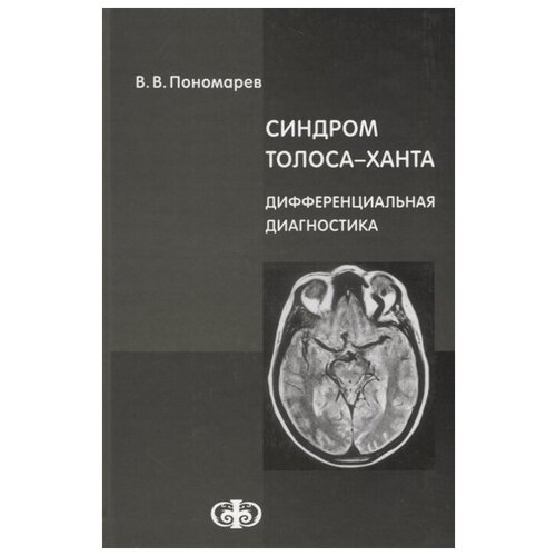 Пономарев В.В. "Синдром Толоса-Ханта. Дифференциальная диагностика"