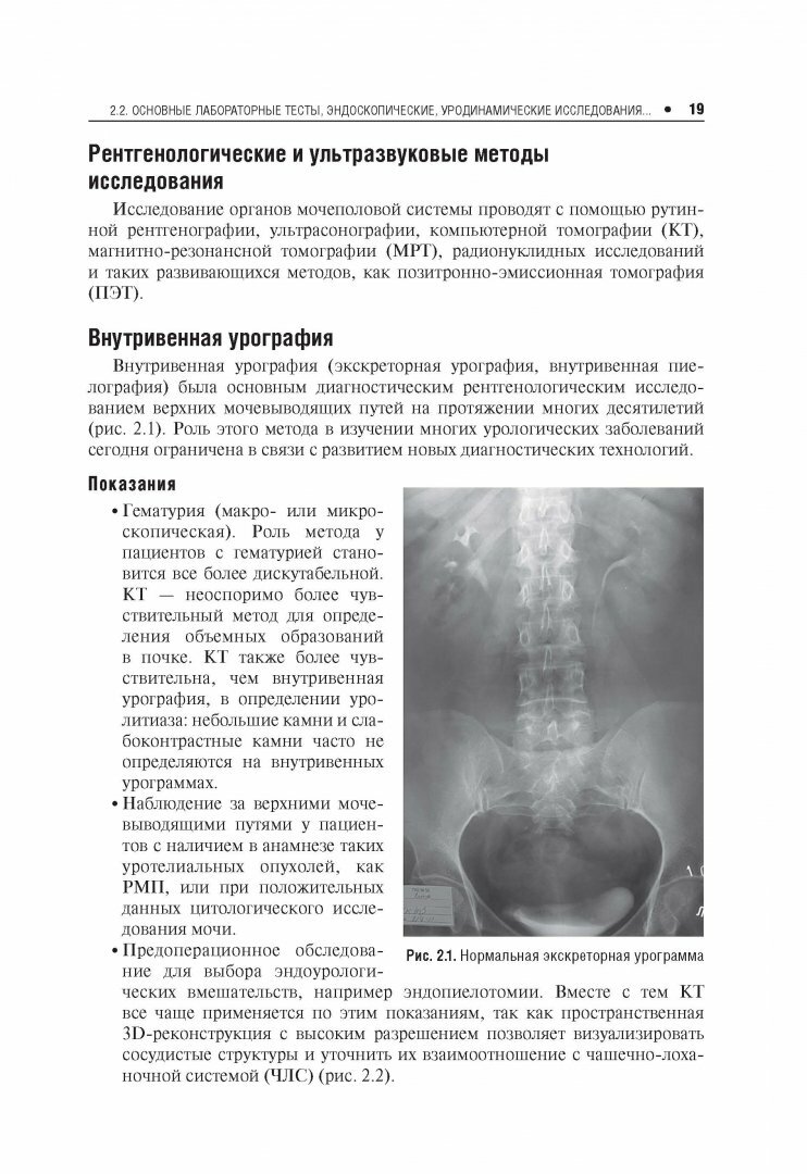 Амбулаторная урология (Пушкарь Дмитрий Юрьевич; Глыбочко Петр Витальевич; Зайцев Андрей Владимирович; Рапопорт Леонид Михайлович) - фото №9