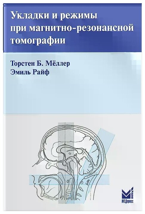 Укладки и режимы при магнитно-резонансной томографии