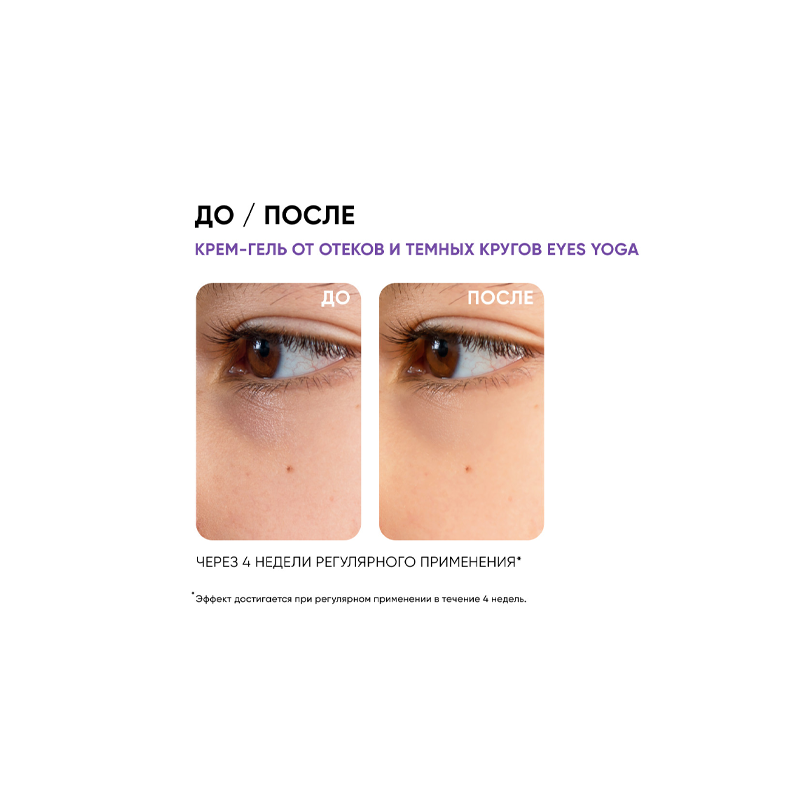 Icon Skin Крем-гель от отеков и темных кругов Eyes Yoga, 15 мл (Icon Skin, ) - фото №18