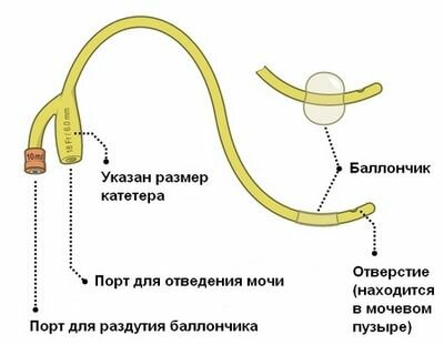 Катетер Урологический Катетер фолея INEKTA, 2-х ходовой, размер СН 28, длина 40 см