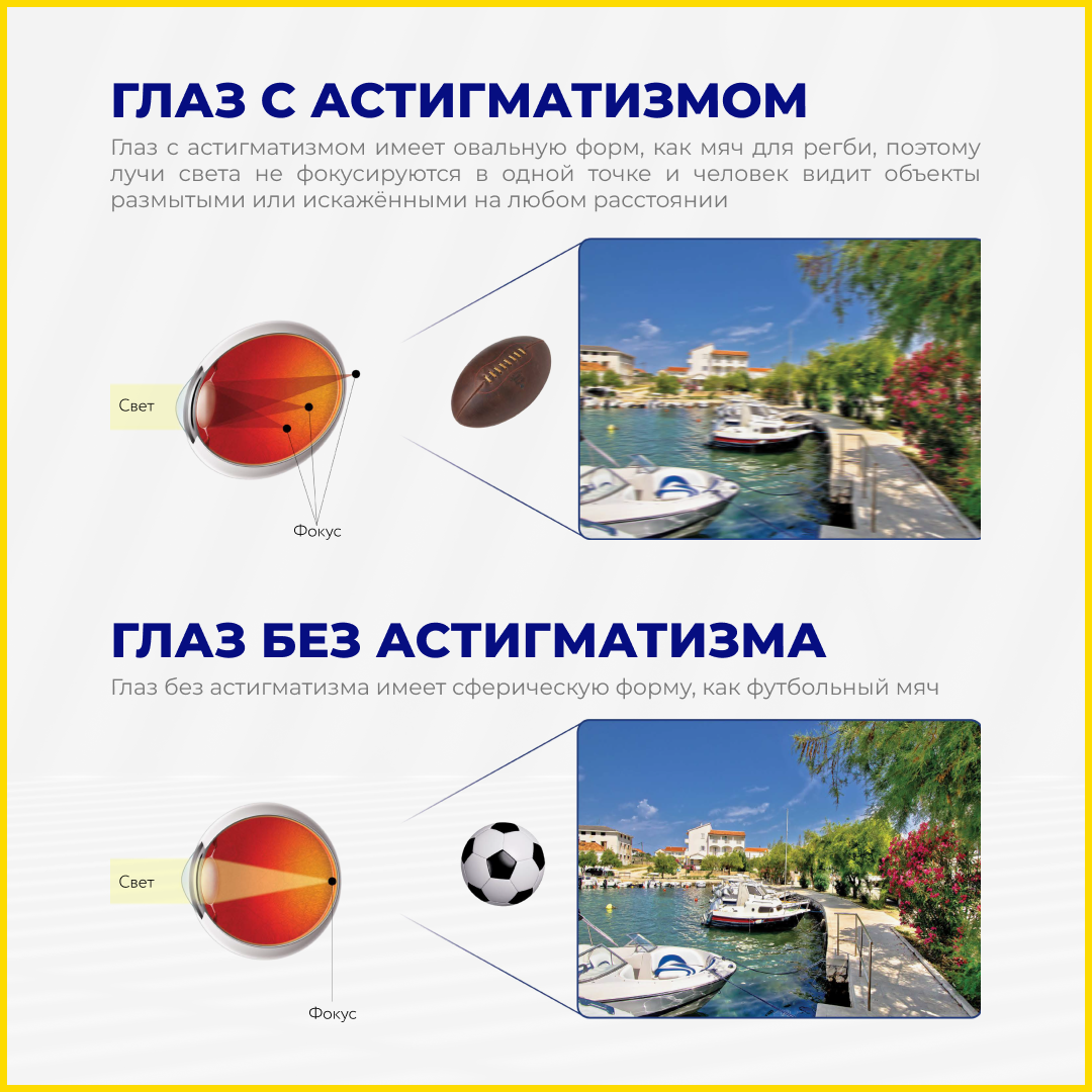 Астигматические линзы 1-Day Acuvue Moist for Astigmatism, 30 шт, -7.50, Ось:10, Цилиндр:-1.25, R:8,5, режим ношения: дневной — фото 1