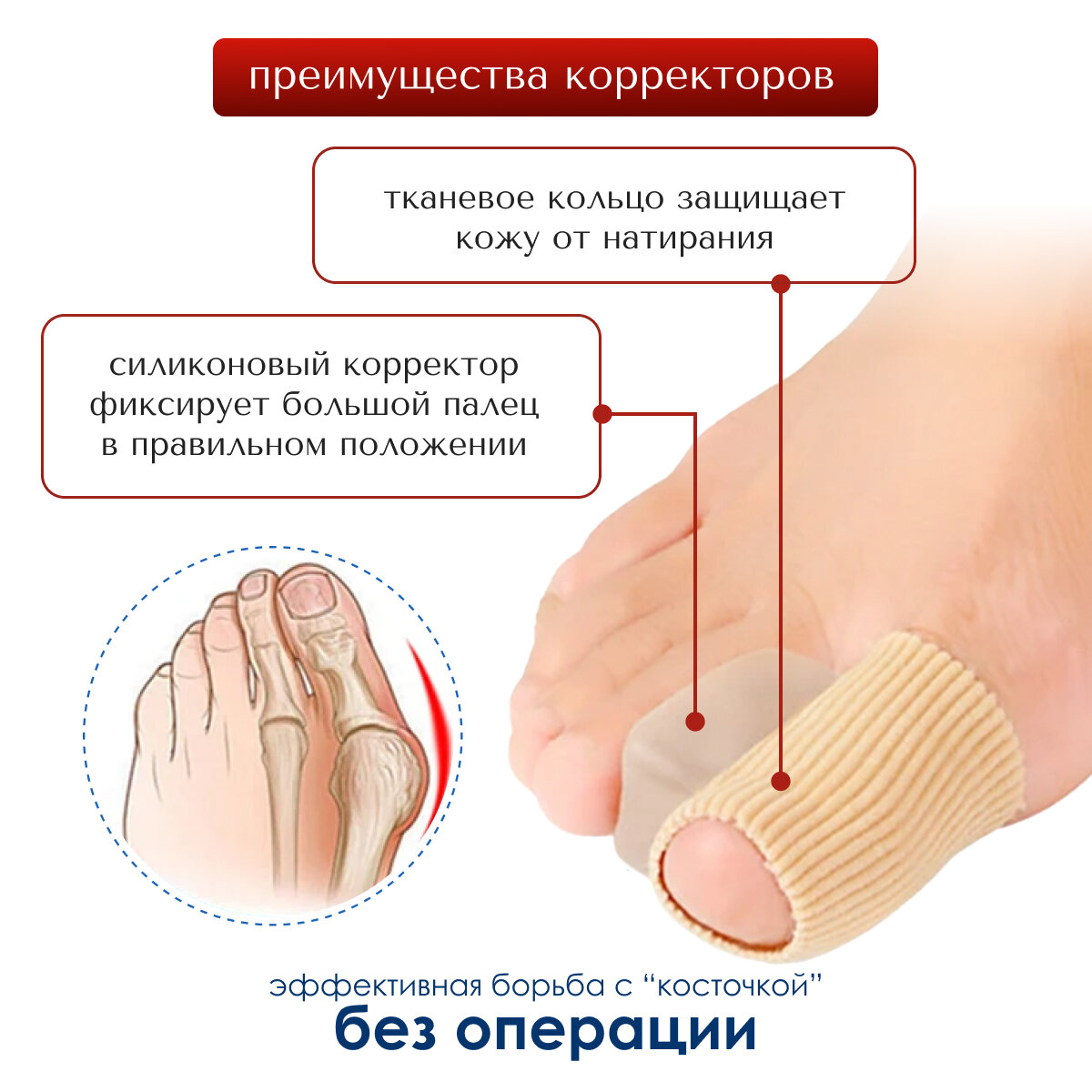Защитные Изделия Для Пальцев Ног Разделитель для пальцев ног MyBalance, напальчник с отведением пальца, бежевый, размер M