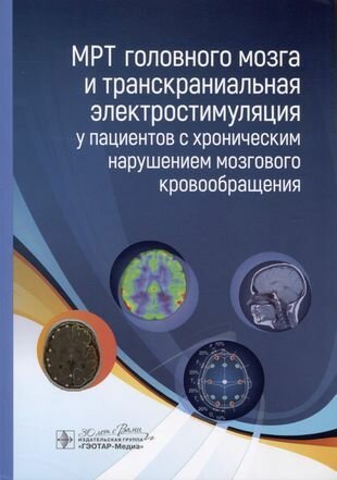 МРТ головного мозга и транскраниальная электростимуляция у пациентов с хроническим нарушением - фото №6
