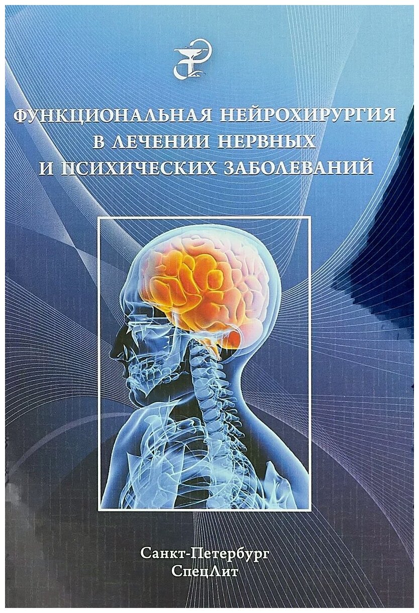Функциональная нейрохирургия в лечении нервных заболеваний - фото №2