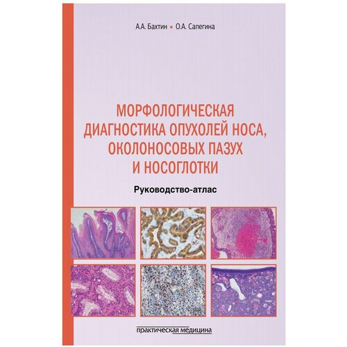 Морфологическая диагностика опухолей носа, околоносовых пазух и носоглотки: руководство-атлас. Бахтин А. А, Сапегина О. А. Практическая медицина