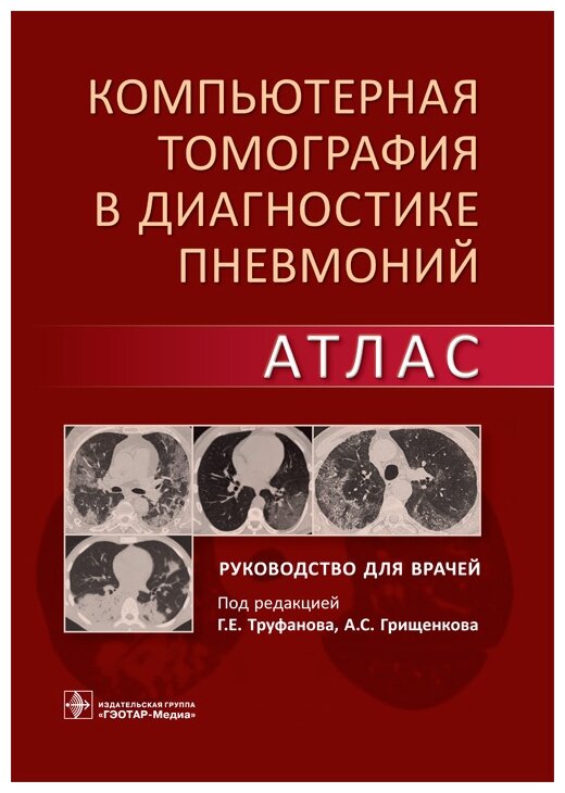 Компьютерная томография в диагностике пневмоний. Атлас - фото №1