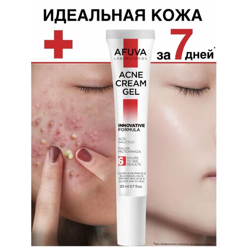 Крем-гель от прыщей и акне на лице и теле, AFUVA, средство от акне, 20 ml