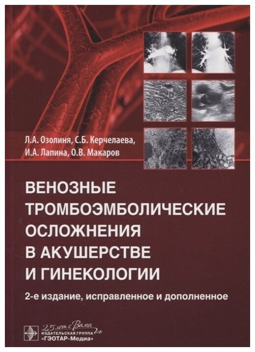 Озолиня Л.А. Керчелаева С.Б. Лапина И.А. Макаров О.В. "Венозные тромбоэмболические осложнения в акушерстве и гинекологии"