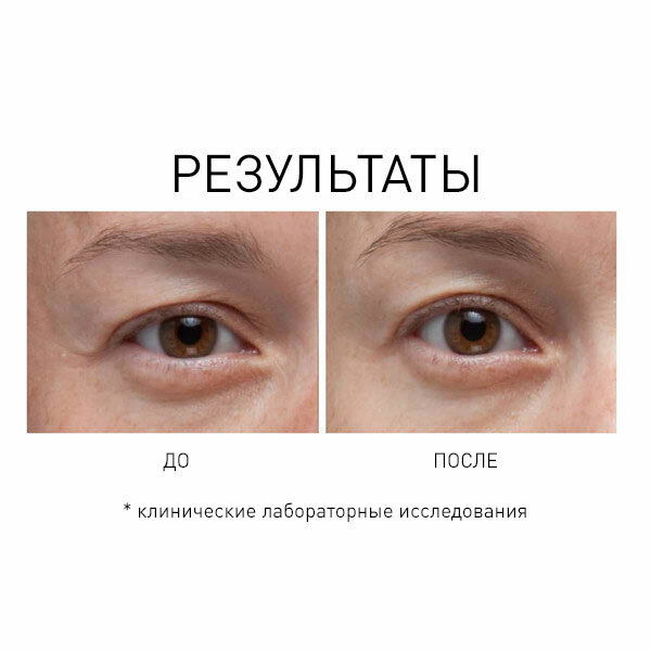 Космедикс Сыворотка для кожи вокруг глаз с жидкими кристаллами 7мл - фото №9