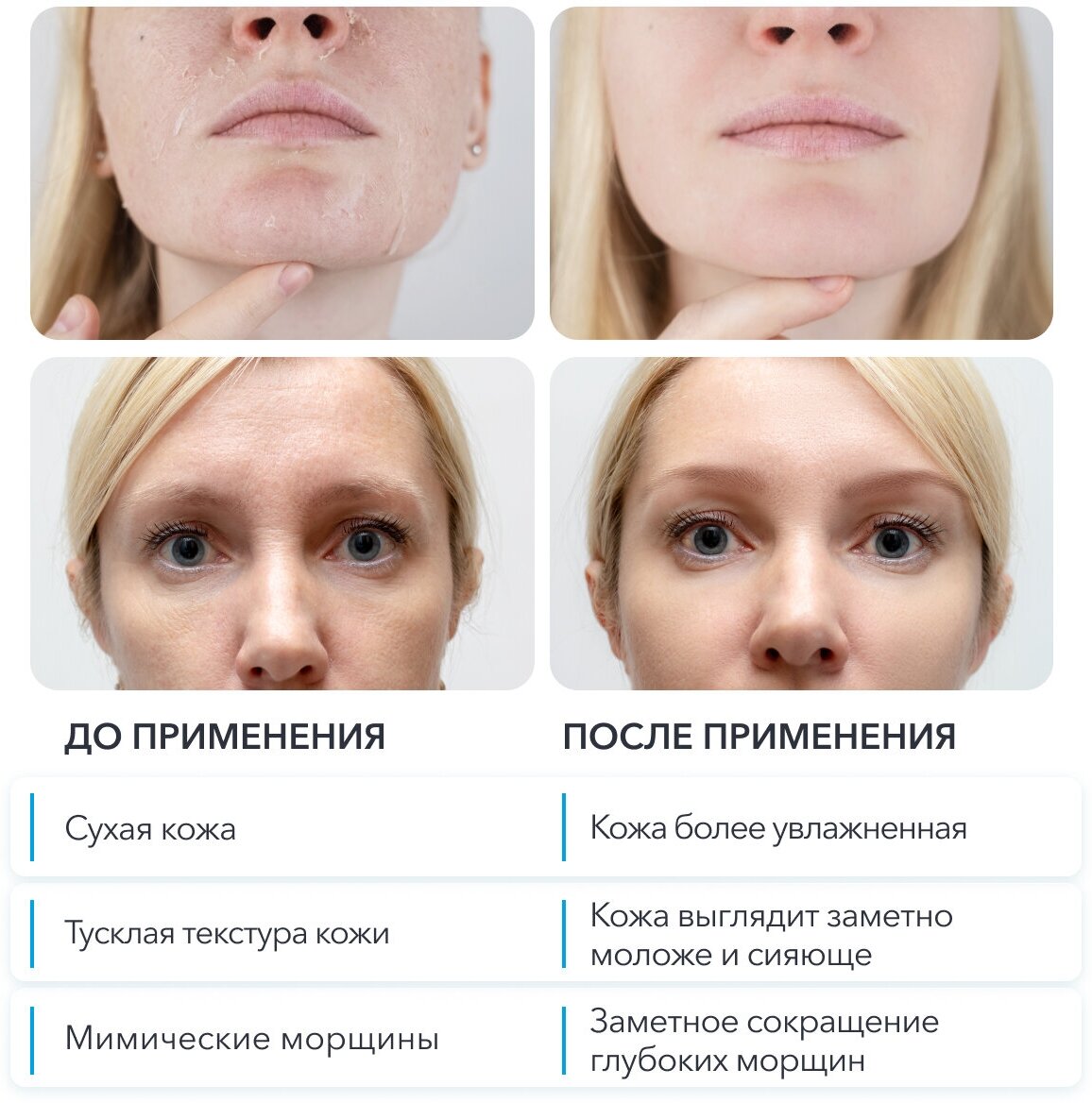 Сыворотка для лица Glatte Anti age антивозрастная от морщин — фото 1