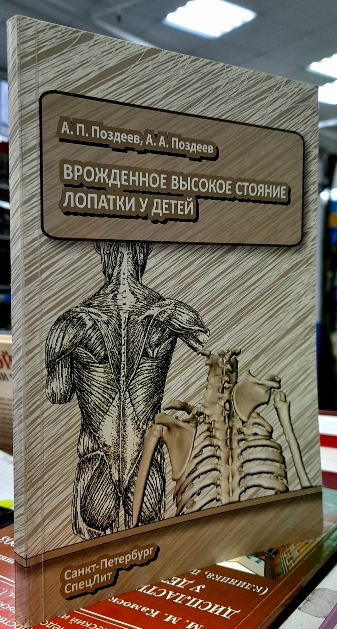 Врожденное высокое стояние лопатки у детей. Поздеев А. П. — фото 1