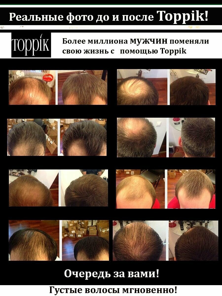 Toppik FiberHold Фиксирующий спрей для волос 118 мл (Toppik, ) - фото №10