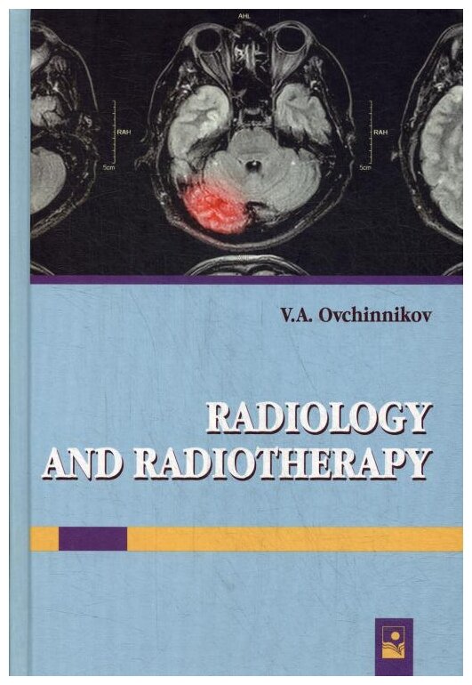 Лучевая диагностика и лучевая терапия. Учебник - фото №1