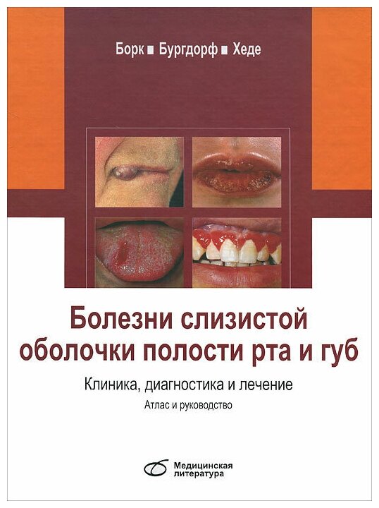 Болезни слизистой оболочки полости рта и губ. Клиника, диагностика и лечение. Атлас и руководство