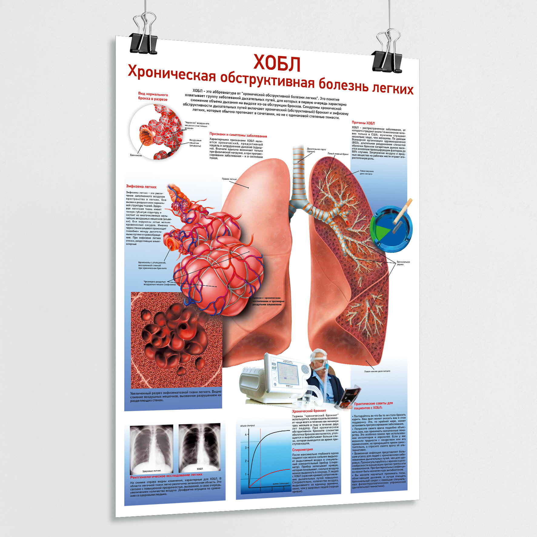 фото Обучающий медицинский плакат "Хобл: Хроническая обструктивная болезнь легких" / ламинированный / А-1 (84x60 см.)