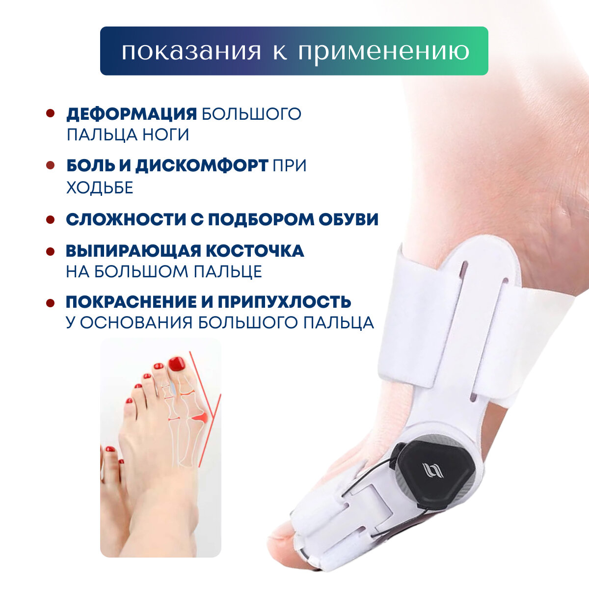 Шины Иммобилизационные Вальгусная шина MyBalance шарнирная с отведением большого пальца, белая, универсальный размер, 1 шт