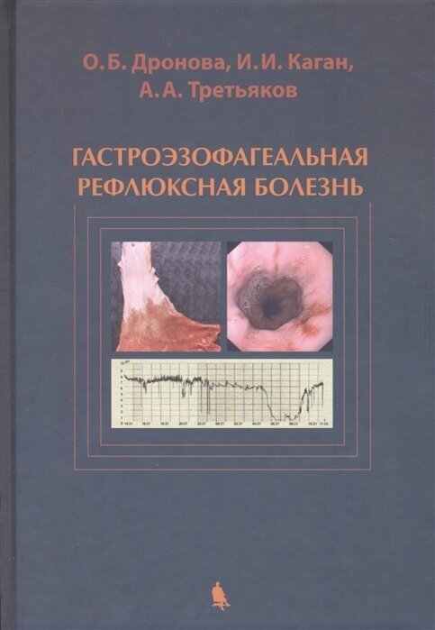 Гастроэзофагеальная рефлюксная болезнь. Анатомо-эндоскопические и клинико-инструментальные основы этиологии, патогенеза, диагностики и лечения