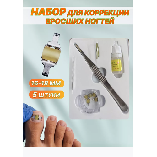 Набор для коррекции для вросших ногтей 10 шт инструмент для коррекции вросших ногтей