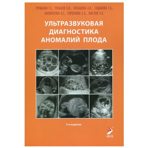 Ультразвуковая диагностика аномалий плода: Руководство для врачей. 3-е изд