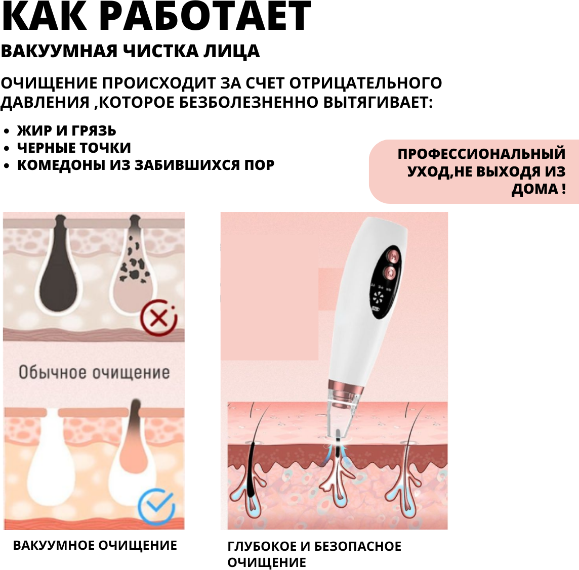 Вакуумный очиститель пор для лица Blackhead Remover Device - фотография № 2