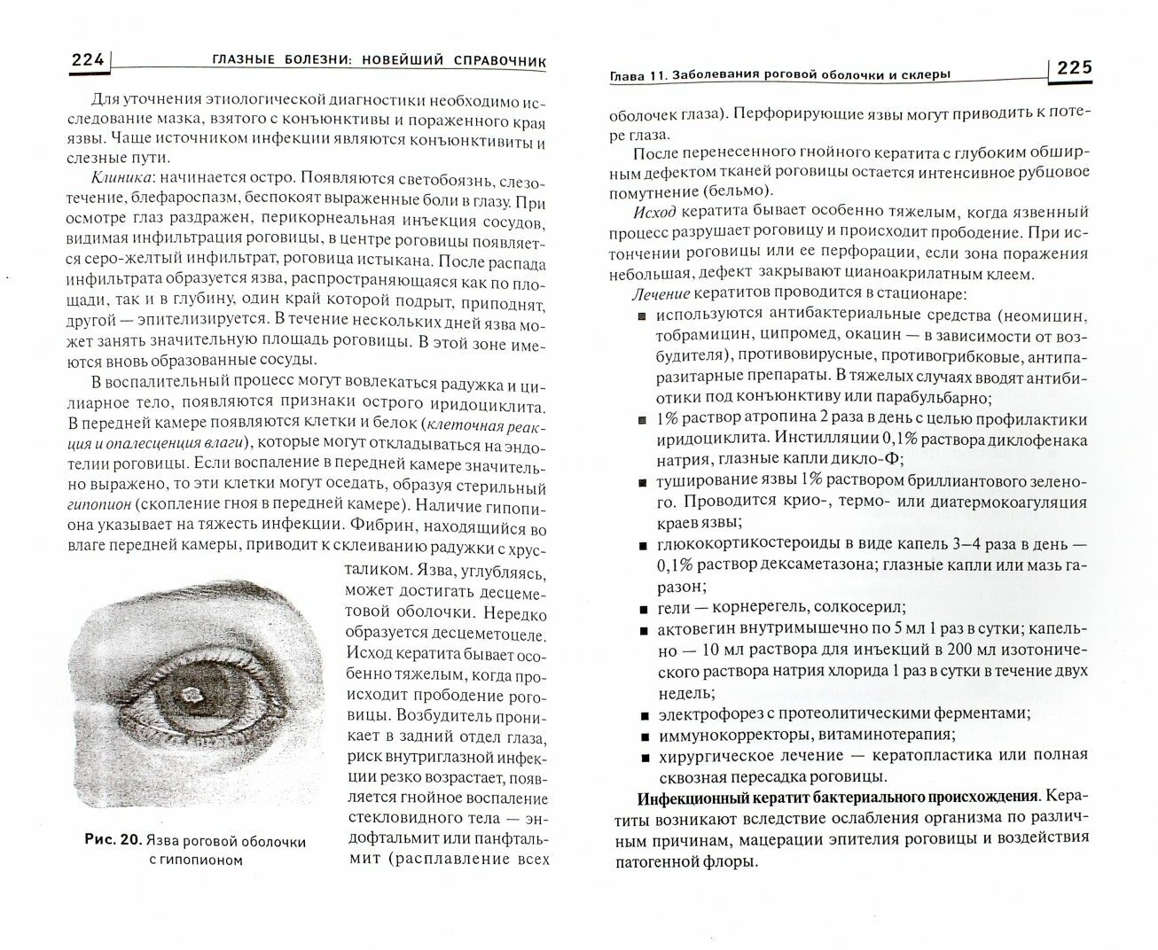 Глазные болезни. Новейший справочник - фото №2