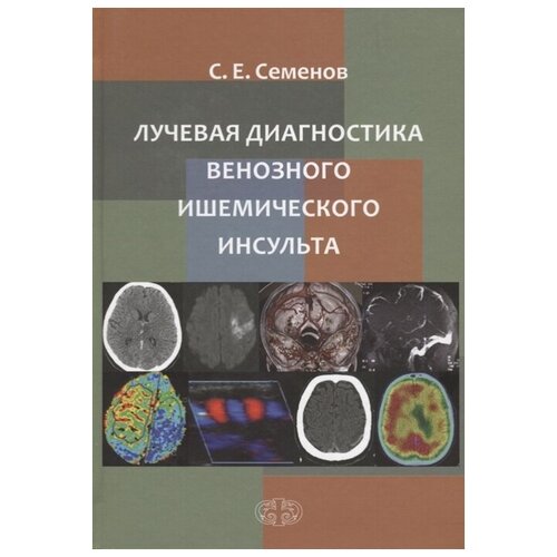 Семенов С. "Лучевая диагностика венозного ишемического инсульта"