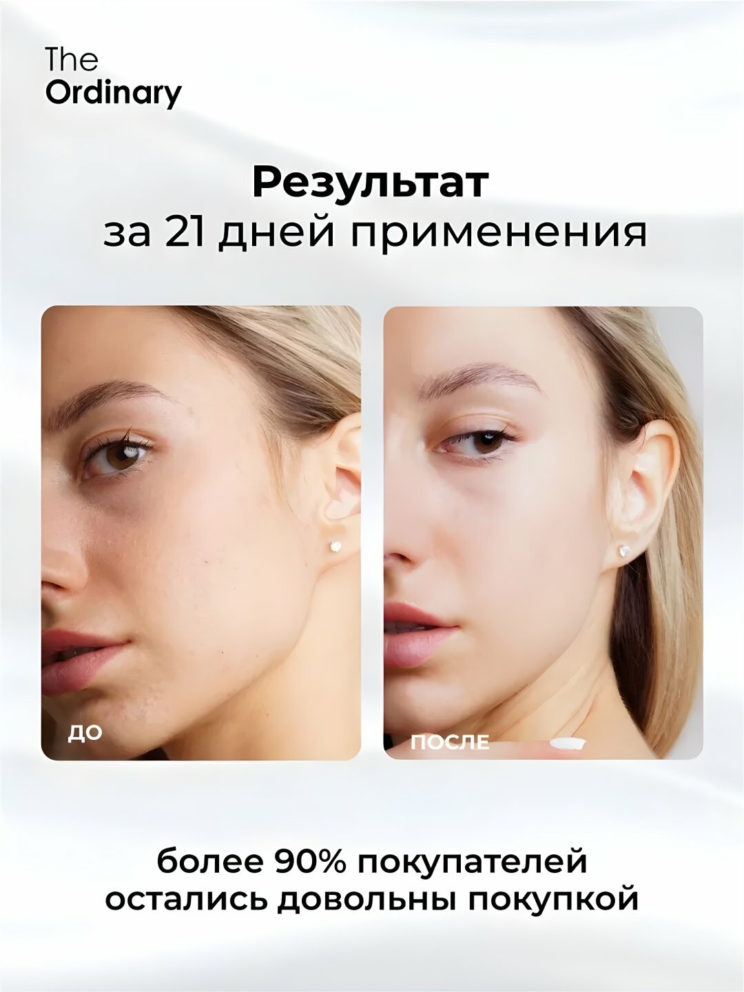 Тоник для лица, The Ordinary, с гликолевой кислотой 7% Toning Solution, 240 мл - Белый — фото 1