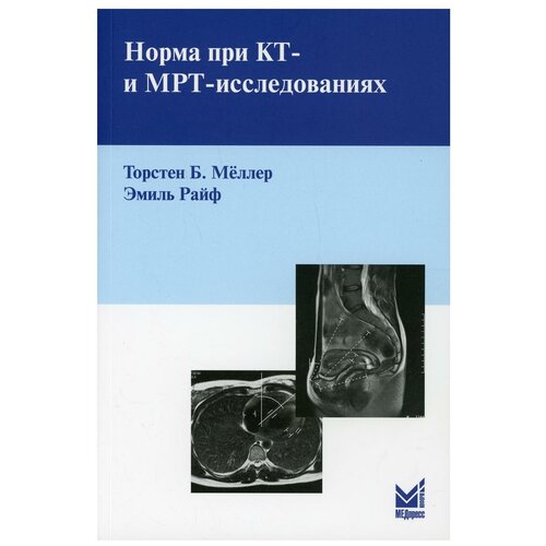 Норма при КТ- и МРТ-исследованиях, 5-е издание