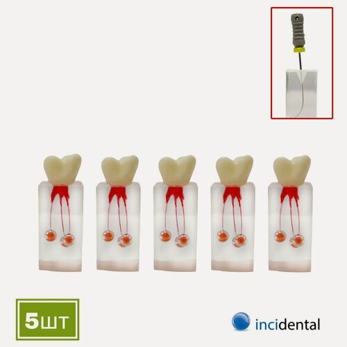 Изображение товара Эндоблок Incidental Дентальный канал с коронковой частью, ( 5шт моляр, три канала окрашен, в области апекса ) N5/31 Прозрачные блоки для обучения и закрепления эндодонтических навыков .