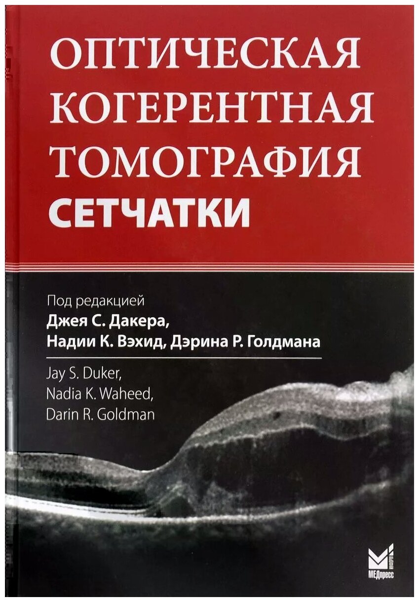 Оптическая когерентная томография сетчатки - фото №1