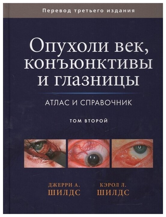 Опухоли век, конъюнктивы и глазницы. Атлас и справочник. В 2-х томах. Том 2 - фото №1