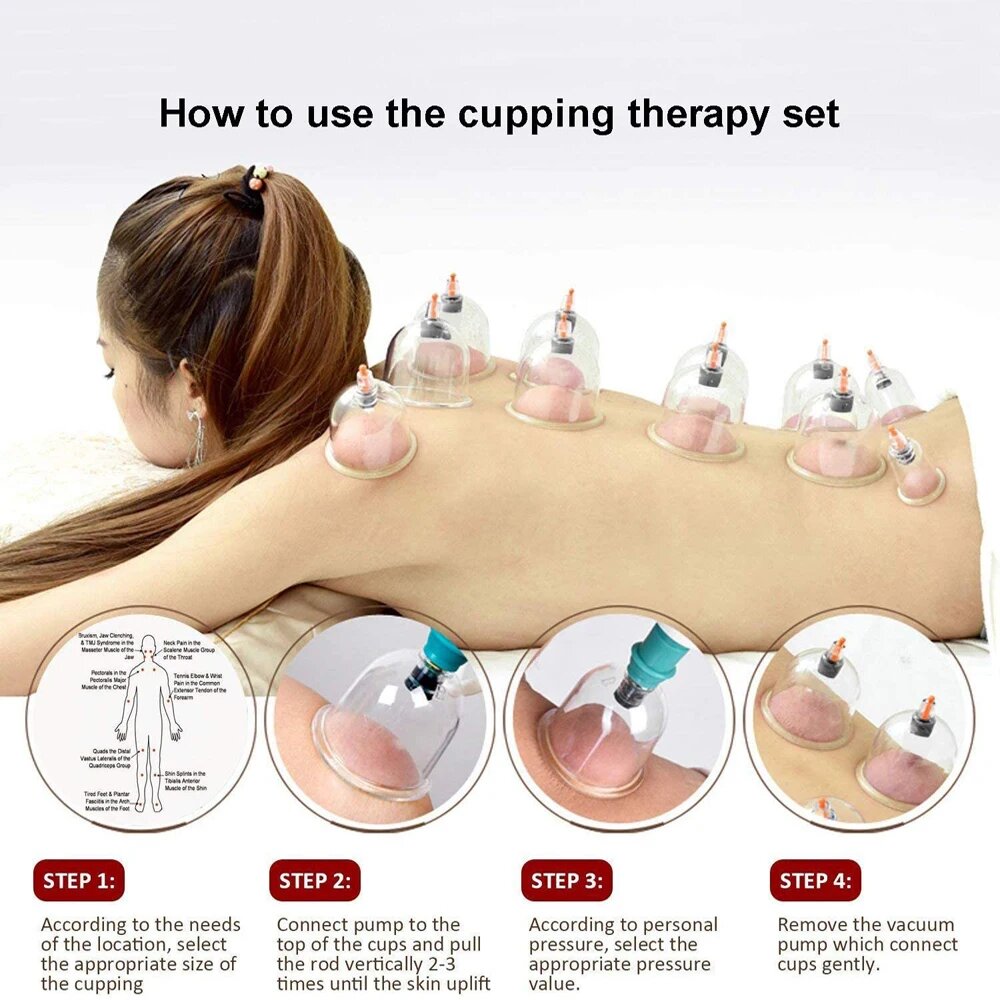 Медицинские Банки Терапевтические наборы для баночной терапии, Hijama вакуумные банки, 24 дюйма, для целлюлитного массажа, для облегчения боли в спине, китайские баночки, 24Pcs-Set