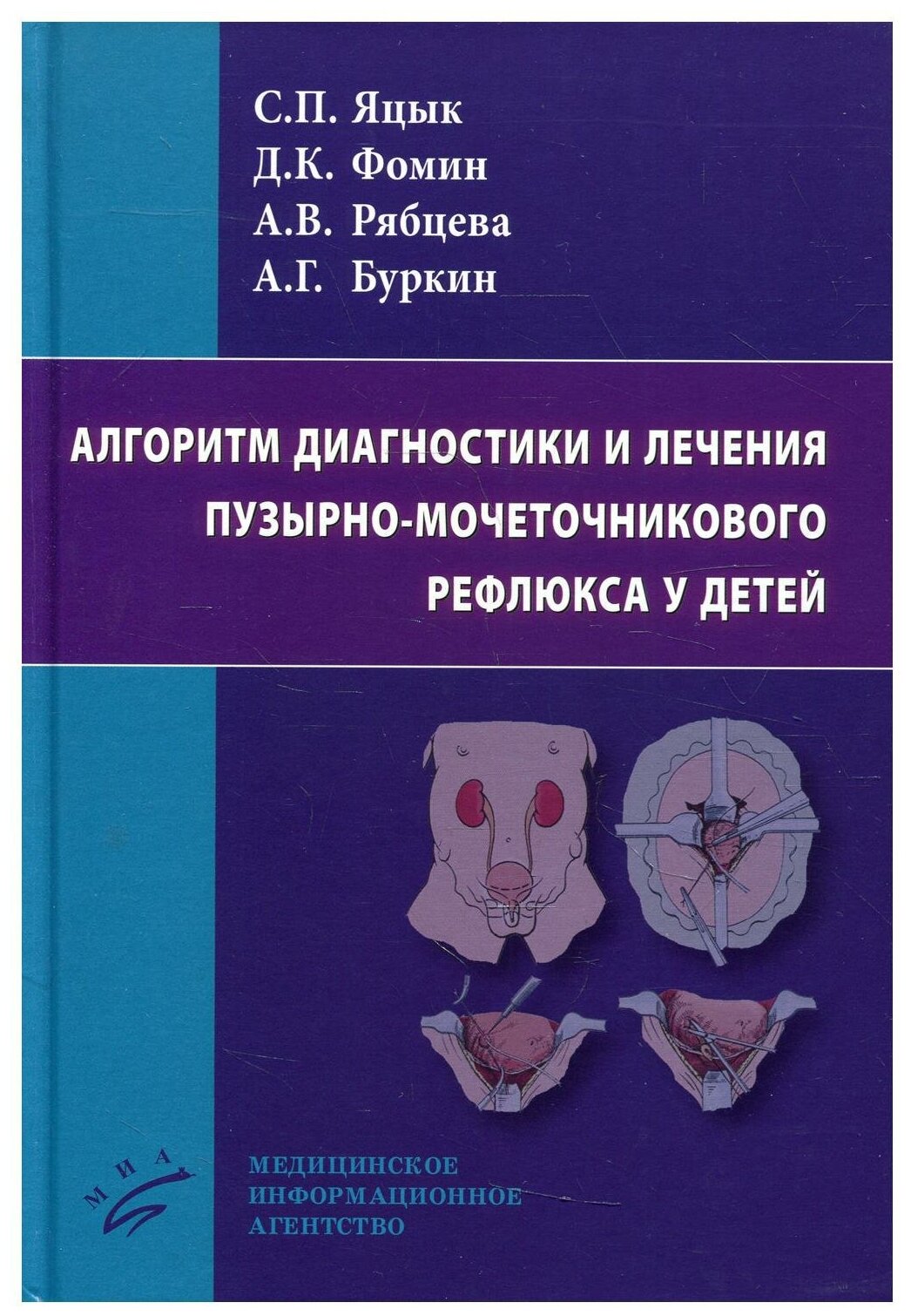 Алгоритм диагностики и лечения пузырно-мочеточникового рефлюкса у детей - фото №3