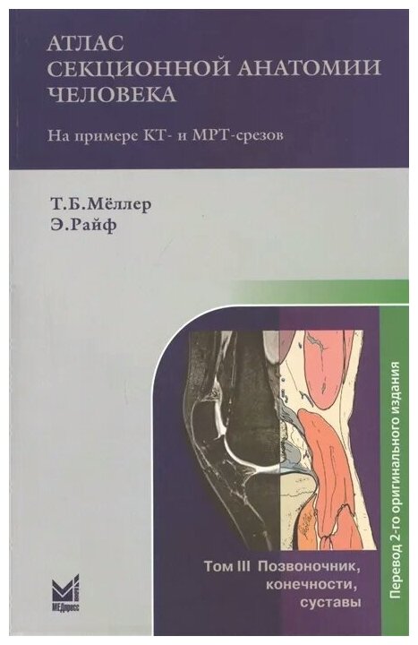 Атлас секционной анатомии человека на примере КТ и МРТ срезов Том 3 Позвоночник конечности суставы Книга Меллер ТБ Райф Э