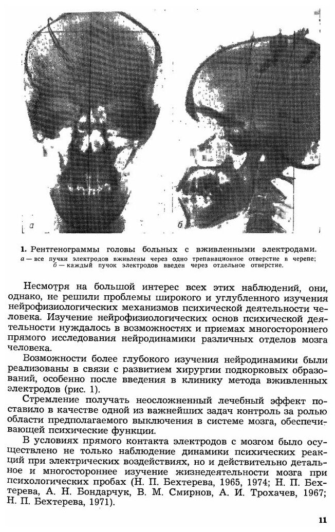 Книга Нейрофизиологические Аспекты психической Деятельности Человека, Издание Второе - фото №8