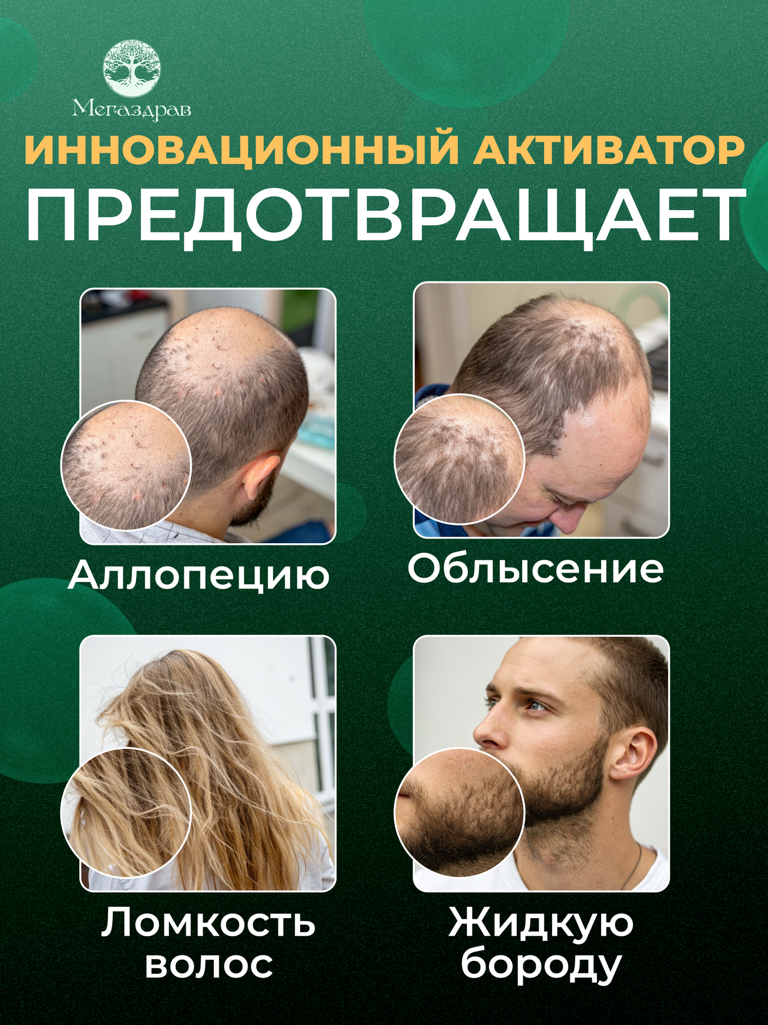 Капиксил 15% Средство для роста волос бороды и бровей / Сыворотка против облысения / Лосьон от выпадения волос — фото 1