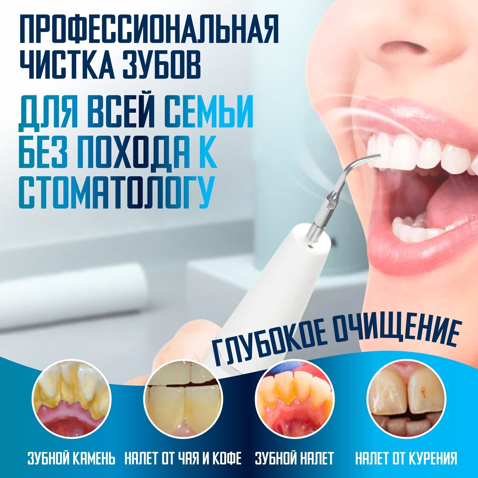 Ультразвуковой скалер для удаления зубного камня My Brilliant Smile 4 насадки