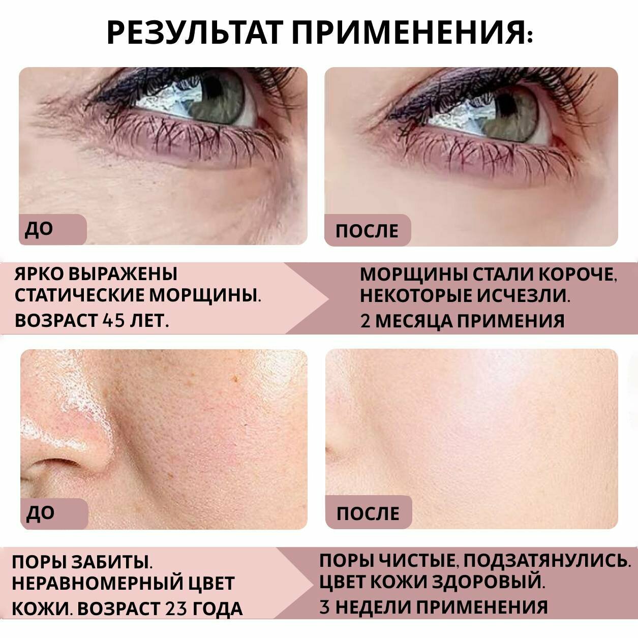 Крем для лица с ретинолом и пептидами (аналог ботокса). Омоложение и красивая кожа — фото 1